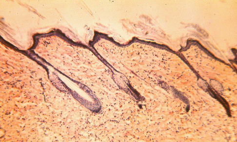 Piel vista al microscopio óptico
