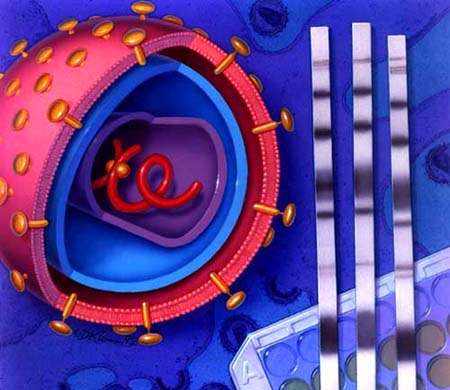 Infección por virus del SIDA