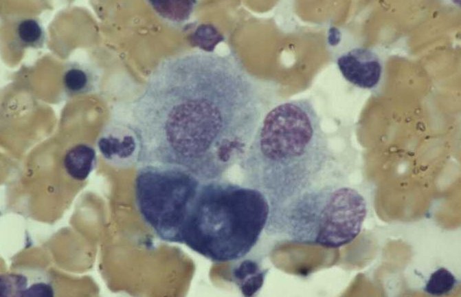Osteoblastos
