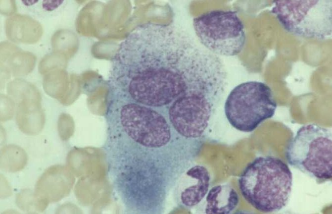 Osteoclastos