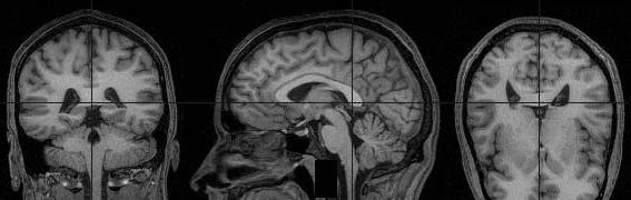Imagen NMR (Nuclear Magnetic Resonance) de un cráneo humano
