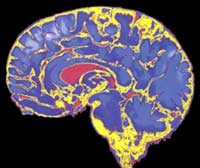  Sección del cerebro humano