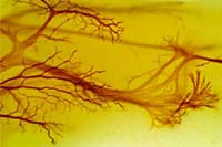 Neurona