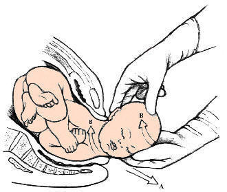 Parto del beb�