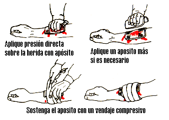 Pres�n Directa