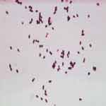 Imagen de Clostridium sp. Obtenida de http://www.consumer.es